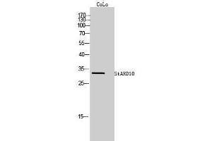 Image no. 1 for anti-StAR-Related Lipid Transfer (START) Domain Containing 10 (STARD10) (Internal Region) antibody (ABIN3187075)