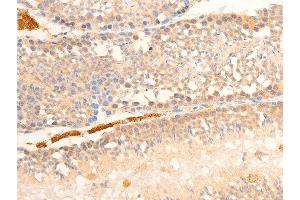Image no. 2 for anti-Nuclear Factor-kB p65 (NFkBP65) (pSer536) antibody (ABIN6255402)