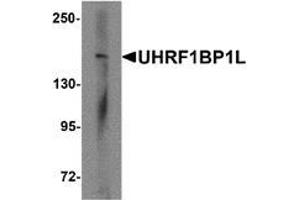 Image no. 2 for anti-UHRF1 (ICBP90) Binding Protein 1-Like (UHRF1BP1L) (Middle Region) antibody (ABIN1450050)