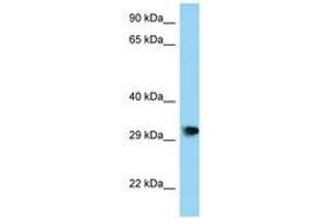 Image no. 1 for anti-PHD Finger Protein 23 (PHF23) (AA 191-240) antibody (ABIN6748146)