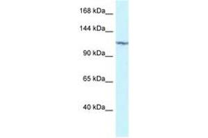 Image no. 1 for anti-Protein Kinase N2 (PKN2) (AA 605-654) antibody (ABIN6747330)