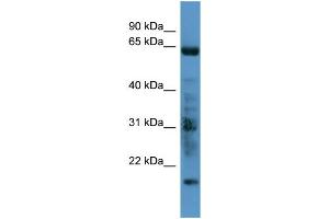 Image no. 1 for anti-G Protein-Coupled Receptor Kinase 7 (GRK7) (C-Term) antibody (ABIN2788227)