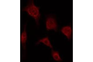 Image no. 3 for anti-Claudin 5 (CLDN5) antibody (ABIN6260869)