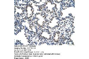 Image no. 2 for anti-REST Corepressor 1 (RCOR1) (N-Term) antibody (ABIN2780965)
