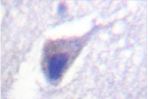 Image no. 2 for anti-Dynamin 1 (DNM1) antibody (ABIN271884)