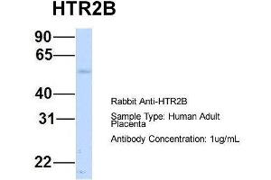 Image no. 2 for anti-Serotonin Receptor 2B (HTR2B) (N-Term) antibody (ABIN2779377)