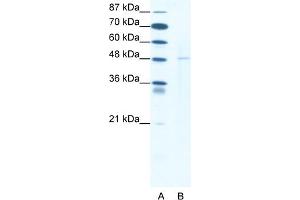 Image no. 1 for anti-DEK Oncogene (DEK) (N-Term) antibody (ABIN2792543)