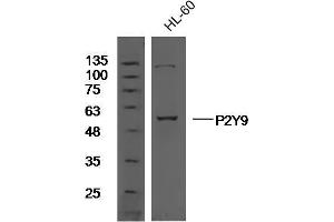 Image no. 5 for anti-Lysophosphatidic Acid Receptor 4 (LPAR4) (AA 175-270) antibody (ABIN1387771)
