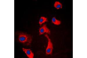 G Protein-Coupled Receptor 116 antibody  (C-Term)