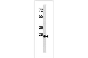 Image no. 1 for anti-kappa Light Chain antibody (ABIN1539833)