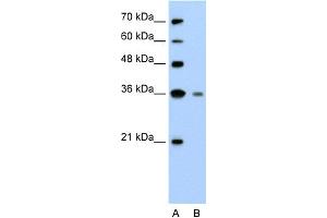Image no. 1 for anti-Granzyme H (Cathepsin G-Like 2, Protein H-CCPX) (GZMH) (N-Term) antibody (ABIN2775539)