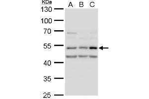 Image no. 1 for anti-Calcium/calmodulin-Dependent Protein Kinase II delta (CAMK2D) (Center) antibody (ABIN2856806)