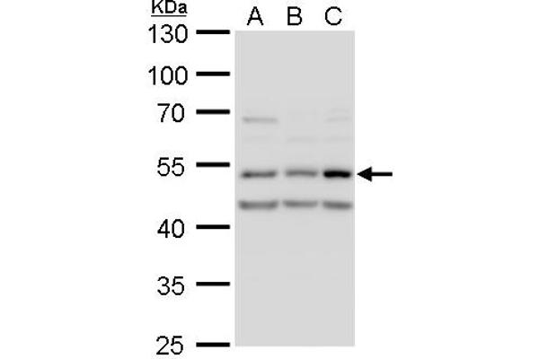 CAMK2D antibody  (Center)