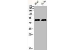 IKBKG Antikörper  (AA 60-120)