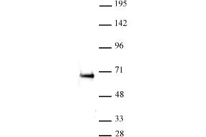 ETO / RUNX1T1 antibody (pAb) tested by Western Blot: K-562 nuclear extract (20 μg per lane) probed with the ETO / RUNX1T1 antibody (pAb) at a dilution of 1:500.