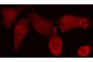 Image no. 3 for anti-Polymerase (DNA Directed), beta (POLB) (C-Term) antibody (ABIN6264332)