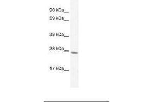 Image no. 2 for anti-General Transcription Factor IIF, Polypeptide 2, 30kDa (GTF2F2) (C-Term) antibody (ABIN6735897)