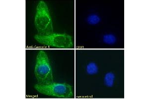 Image no. 8 for anti-Caveolin 1, Caveolae Protein, 22kDa (CAV1) (Internal Region) antibody (ABIN185421)