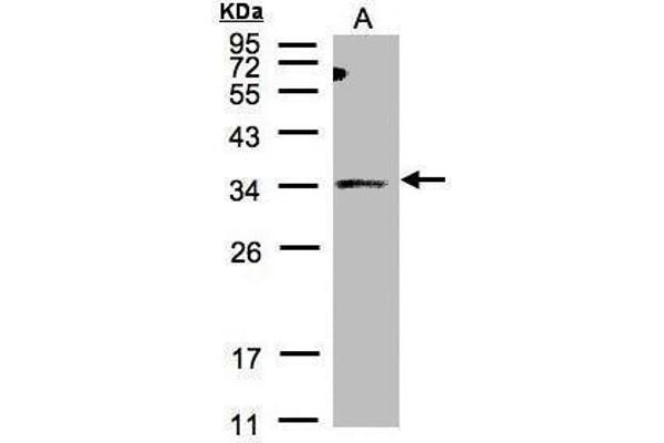 ST3GAL1 antibody  (Center)