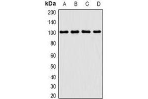 Image no. 1 for anti-Protein-L-Isoaspartate (D-Aspartate) O-Methyltransferase (PCMT1) (full length) antibody (ABIN6004506)