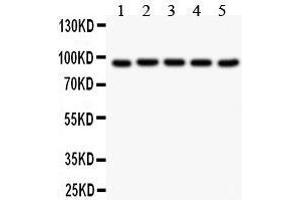 Image no. 3 for anti-Villin 1 (VIL1) (AA 770-799), (C-Term) antibody (ABIN3042343)