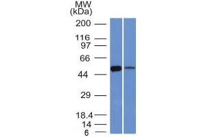 Image no. 1 for anti-Aldehyde Dehydrogenase 1 Family, Member A1 (ALDH1A1) (AA 315-434) antibody (ABIN6939366)