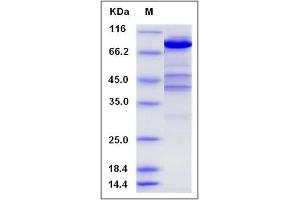 Image no. 1 for Ezrin (EZR) (AA 2-586), (Mature) protein (His tag) (ABIN2005343)