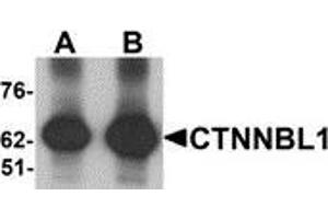 Image no. 1 for anti-Catenin, beta Like 1 (CTNNBL1) (C-Term) antibody (ABIN783411)