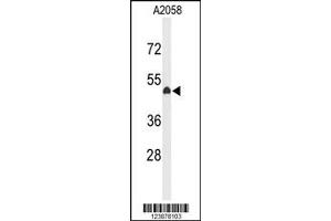 Western Blotting (WB) image for anti-Eyes Absent Homolog 4 (EYA4) antibody (ABIN2158766)