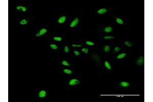 Immunofluorescence of purified MaxPab antibody to WDR4 on HeLa cell.