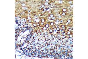 Immunohistochemistry of paraffin-embedded Human esophageal using SPECC1L Rabbit pAb (ABIN7270521) at dilution of 1:100 (40x lens).