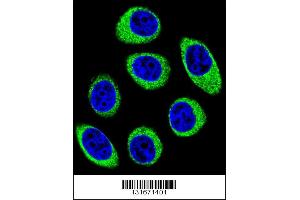 Image no. 3 for anti-Protocadherin 1 (PCDH1) (AA 179-206), (N-Term) antibody (ABIN655958)