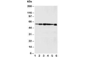 Image no. 3 for anti-Abl-Interactor 1 (ABI1) (C-Term) antibody (ABIN3029824)