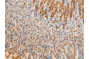 Image no. 7 for anti-Nuclear Factor-kB p65 (NFkBP65) (pSer536) antibody (ABIN6255402)
