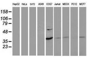 Image no. 2 for anti-PDZ and LIM Domain 2 (PDLIM2) antibody (ABIN1500128)