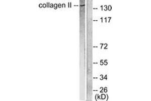 Image no. 2 for anti-Collagen, Type II (COL2) (AA 101-150) antibody (ABIN1533237)