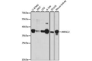 Image no. 3 for anti-Aldo-Keto Reductase Family 1, Member C3 (3-alpha Hydroxysteroid Dehydrogenase, Type II) (AKR1C3) antibody (ABIN3022536)