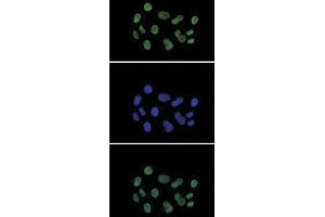 Image no. 6 for anti-Histone Cluster 1, H3a (HIST1H3A) (acLys27) antibody (ABIN5773852)
