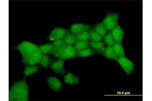 Immunofluorescence of purified MaxPab antibody to PTTG1 on 293 cell.