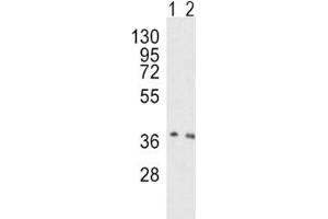 Image no. 2 for anti-8-Oxoguanine DNA Glycosylase (OGG1) (AA 318-345) antibody (ABIN3028439)