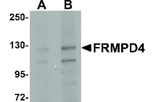 FRMPD4 antibody  (Internal Region)