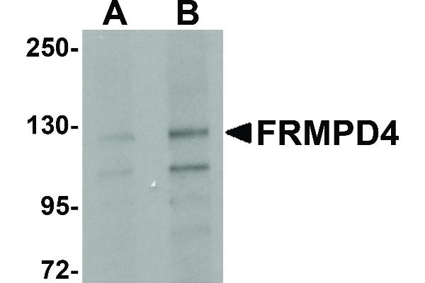 anti-FERM and PDZ Domain Containing 4 (FRMPD4) (Internal Region) antibody