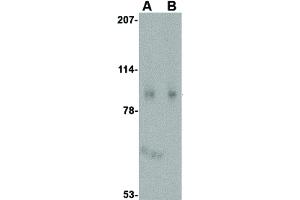 Image no. 3 for anti-SLIT and NTRK-Like Family, Member 1 (SLITRK1) (C-Term) antibody (ABIN6657132)