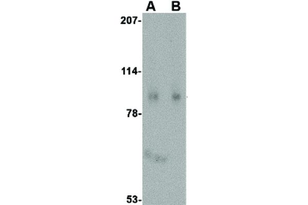 SLITRK1 Antikörper  (C-Term)