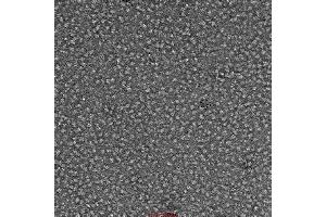 Electron Microscopy (EM) image for SARS-CoV-2 Spike (Super Stable Trimer) protein (His tag) (ABIN6953302)