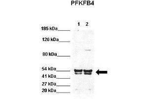 Image no. 2 for anti-6-phosphofructo-2-Kinase/fructose-2,6-Biphosphatase 4 (PFKFB4) (N-Term) antibody (ABIN2786782)
