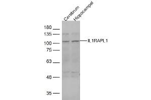 anti-Interleukin 1 Receptor Accessory Protein-Like 1 (IL1RAPL1) (AA 301-400) antibody