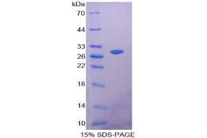 Image no. 1 for Signal-Regulatory Protein beta 1 (SIRPB1) (AA 127-356) protein (His tag) (ABIN2126753)