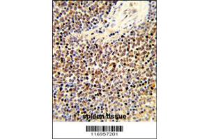 Immunohistochemistry (IHC) image for anti-Cytochrome P450, Family 24, Subfamily A, Polypeptide 1 (CYP24A1) antibody (ABIN2158437)