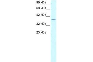 Image no. 1 for anti-Kruppel-Like Factor 8 (KLF8) (Middle Region) antibody (ABIN2777635)